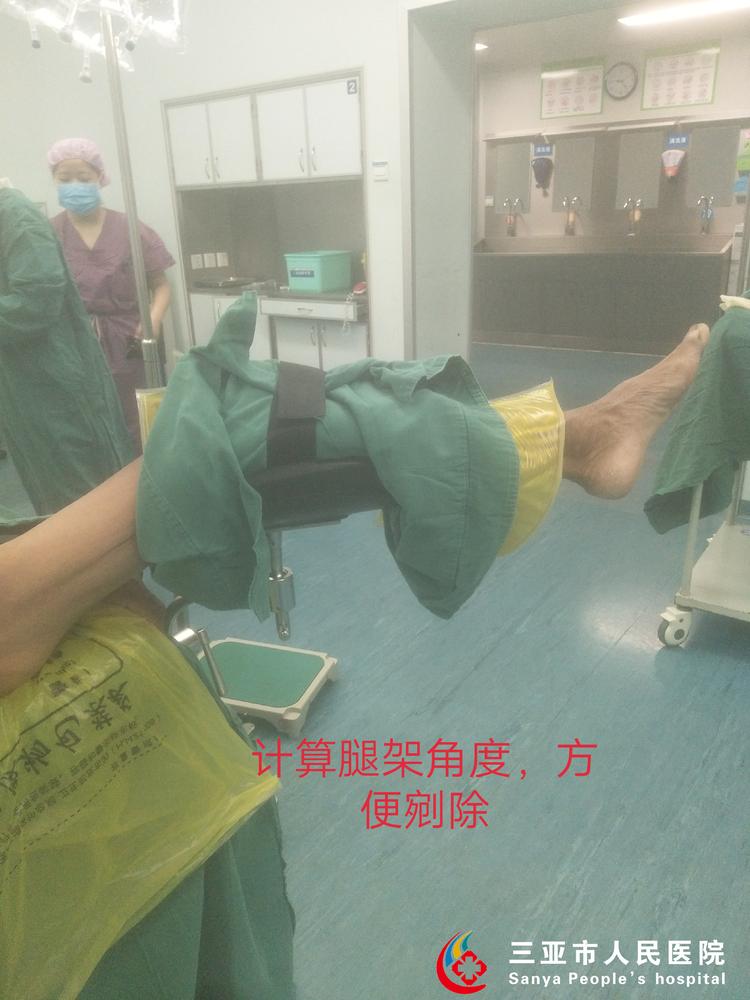 用技术挽留夕阳之美——三亚市人民医院泌尿外科成功为93岁高龄老人实施经尿道等离子前列腺剜除术