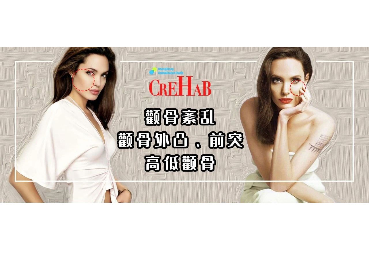 两边颧骨不一样大小如何调整,如何判断颧骨外扩还是颧骨突出