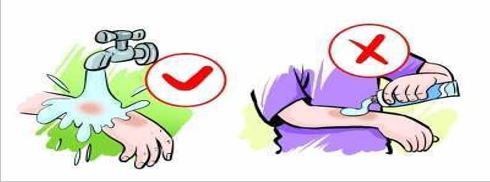 当小孩被烫伤,小孩用开水烫伤到底要不要包扎