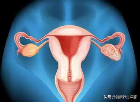 女性出现这4种症状要小心,女性宫颈癌症状