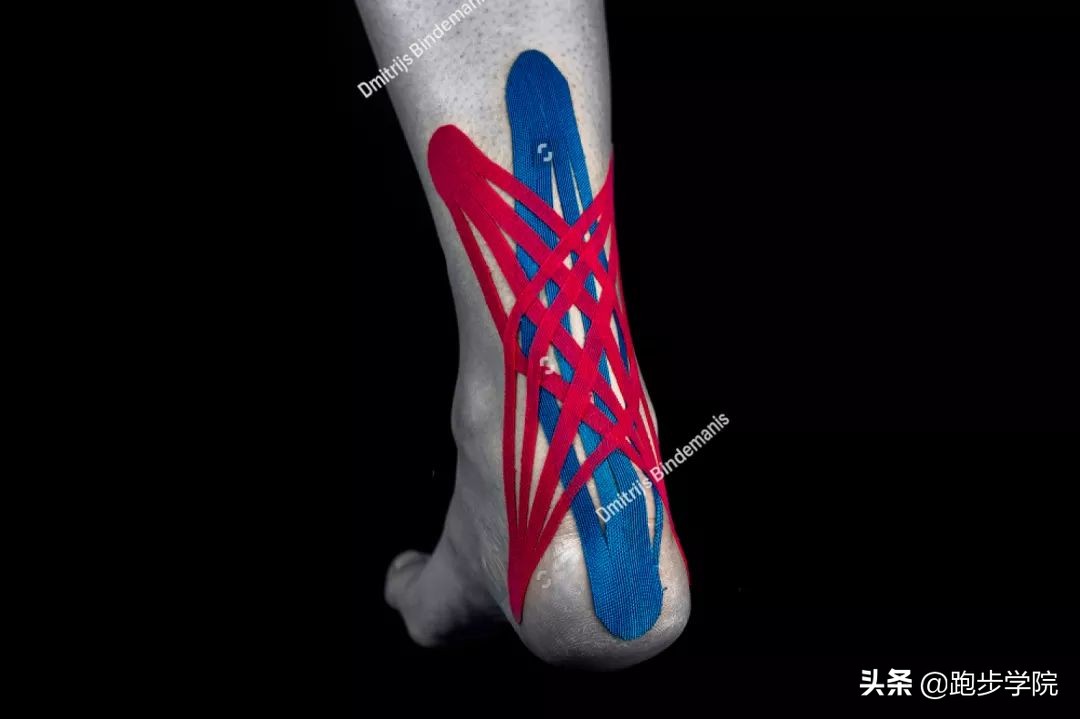 跑步怎样预防跟腱炎,预防跟腱炎最好的方法