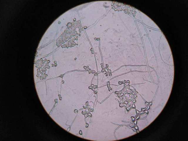 土壤质地改良措施有哪些,土壤有机质改良的主要方法