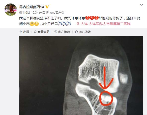 一方迎来赛季最艰难一战!主力后防线全部报销一特质或带来惊喜