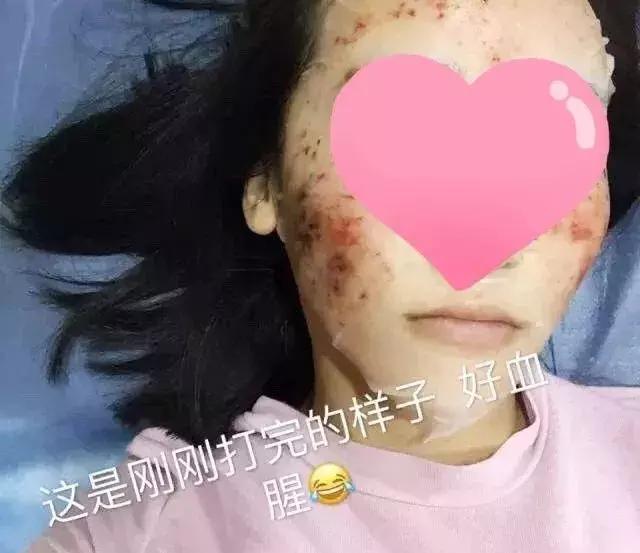 25岁以后用含什么成分的护肤品,25岁前护肤品用什么样的