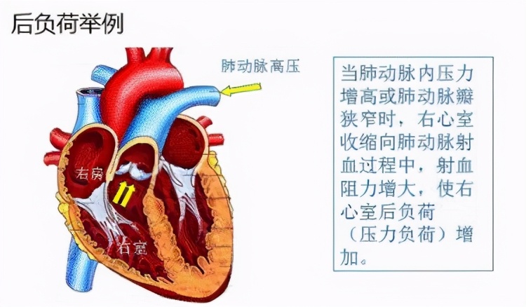高血压心脏病高发,得了高血压病怎么办
