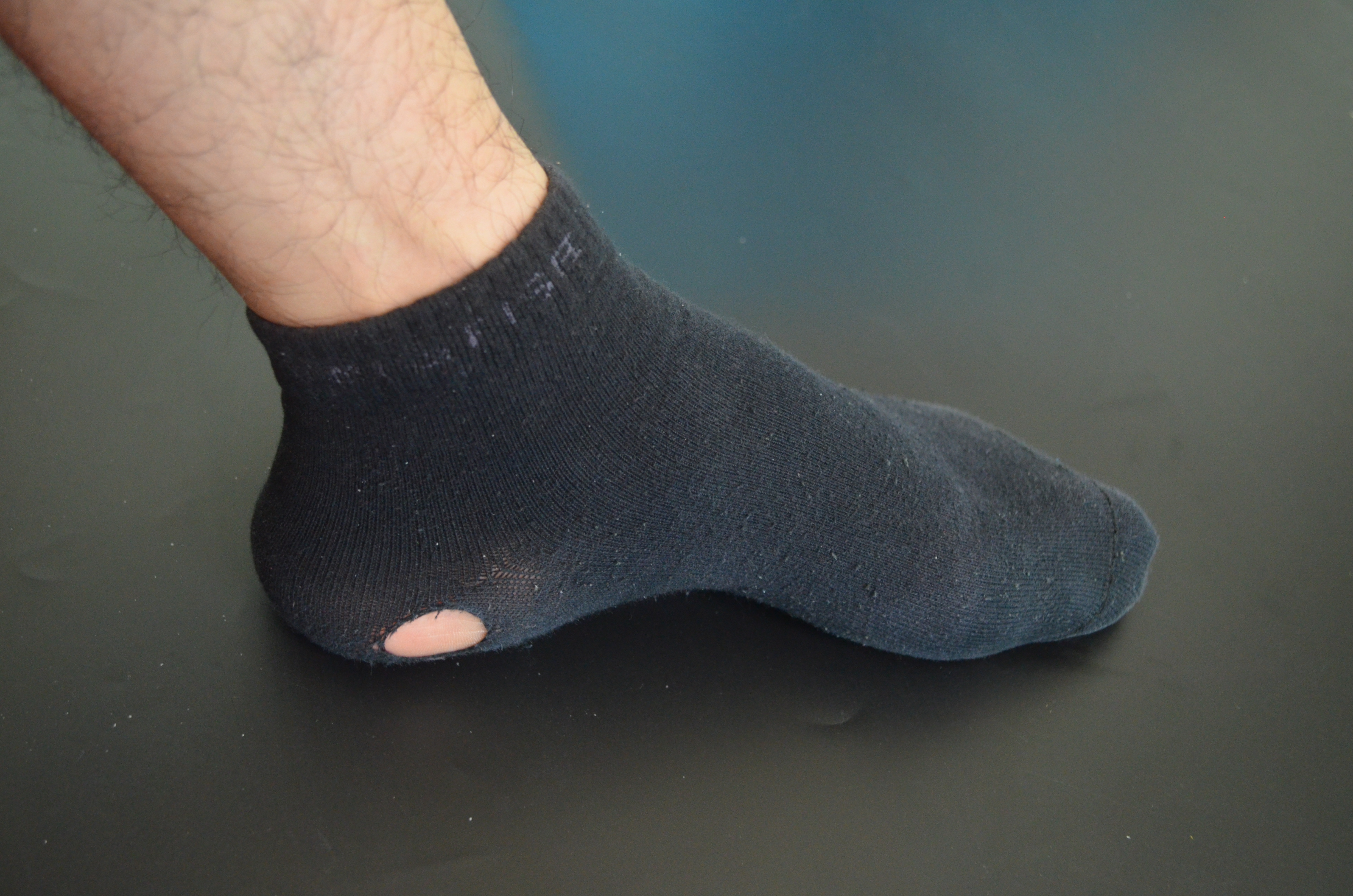 袜子破洞巧妙修补方法生活小妙招,防止袜子破洞小妙招