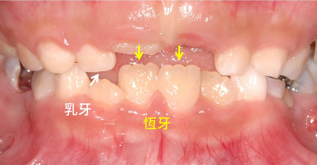 姚晨孩子片段,姚晨晒孩子视频全集