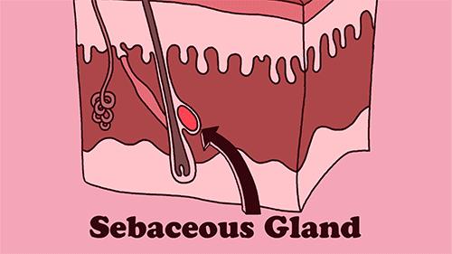 如何祛除痘印最有效的几招,教你几种有效去除痘印的方法