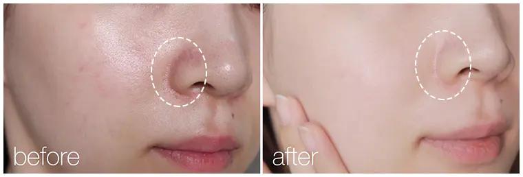 用绵羊油护肤皮肤竟如此水润饱满,莱蔻澳洲绵羊油多效水润嫩肤霜