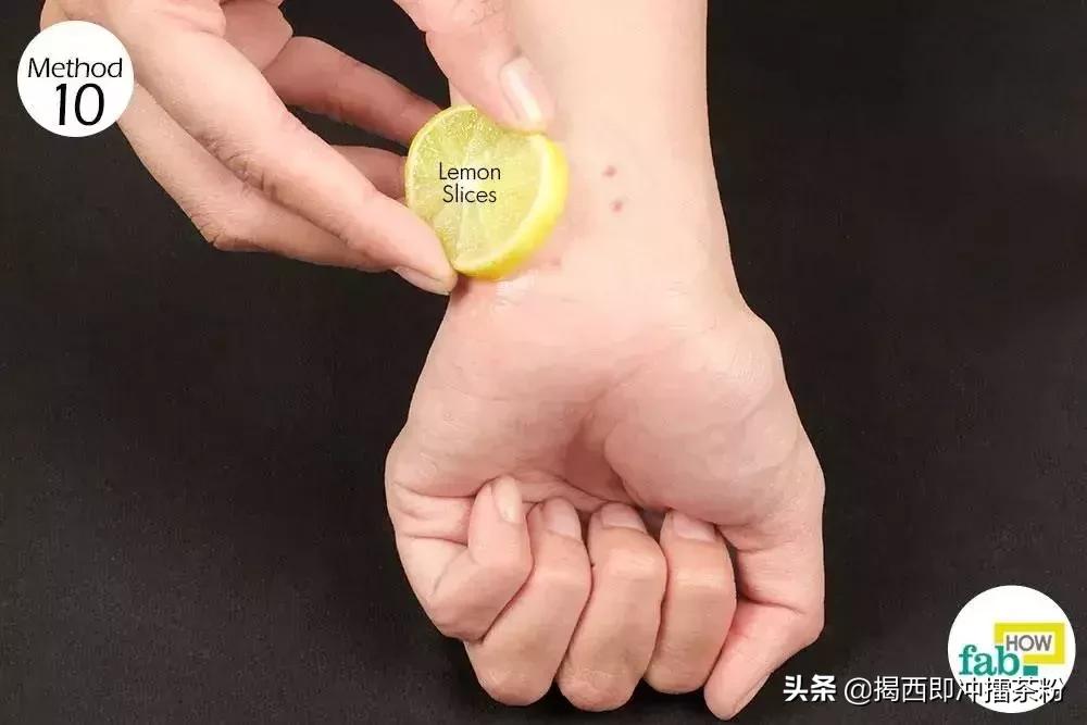 被蚊子咬了可以涂丁酸氢化可的松,被蚊子咬了但什么都没带