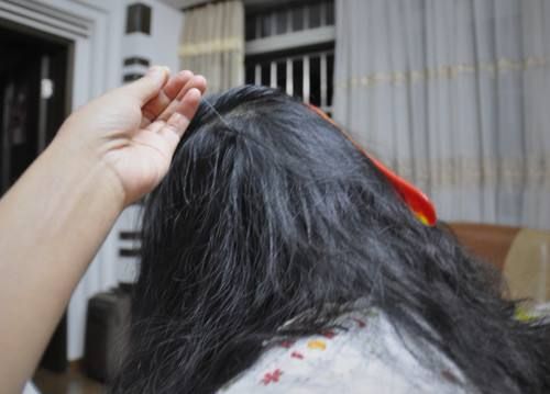 少年白发如何处理好看呢,少年白发自己怎么治