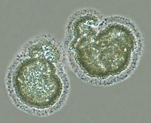 养殖菌菇需要什么条件,养殖菌和种植菌区别