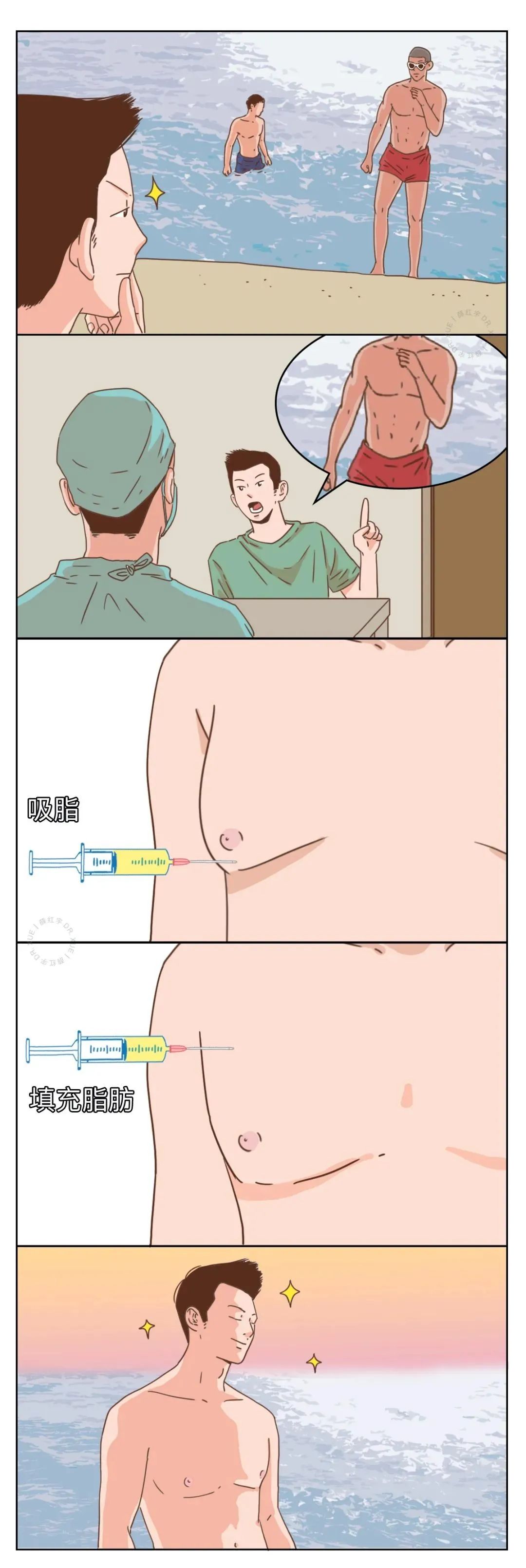 男性隆胸,男性隆胸后续