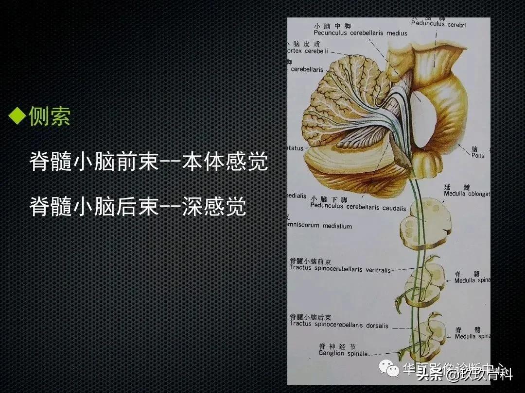 颈椎病脊髓变性mri表现,脊髓亚急性联合变性的诊断