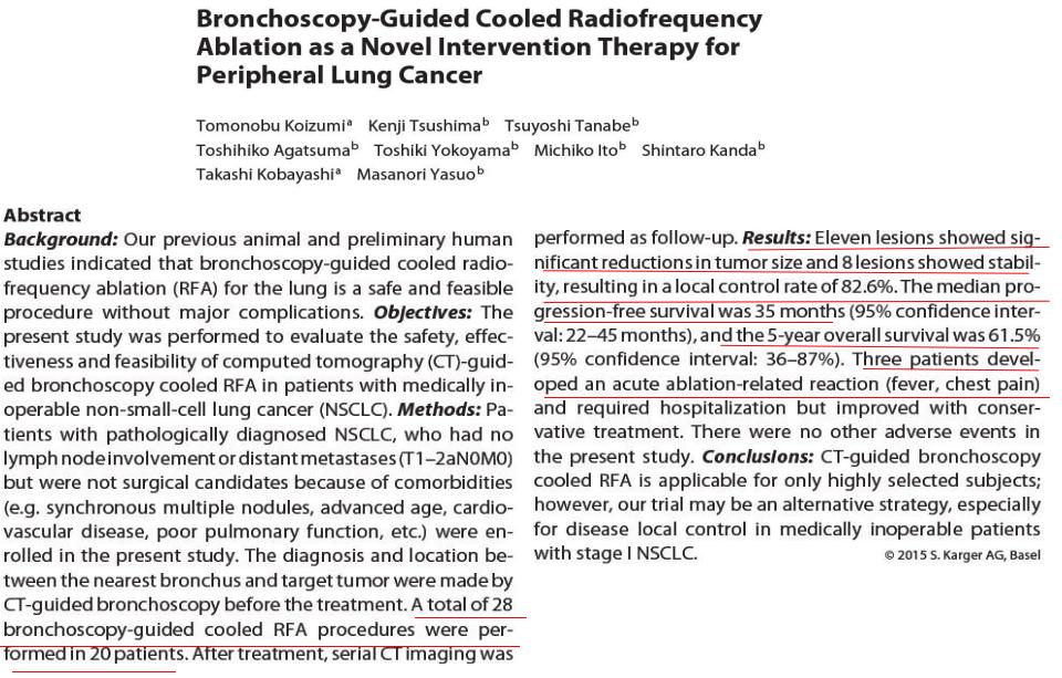 小细胞肺癌的气管镜介入治疗,导航支气管镜在肺癌诊断中的应用