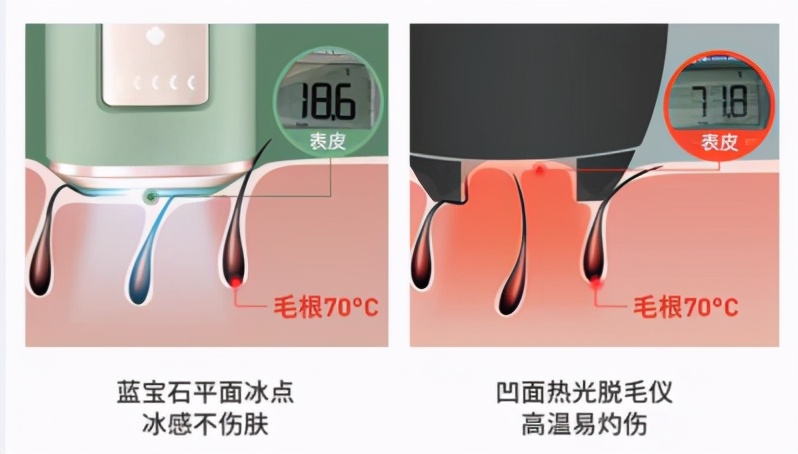 双十一宅美护消费爆发式增长,Ulike脱毛仪连续5年销量第一