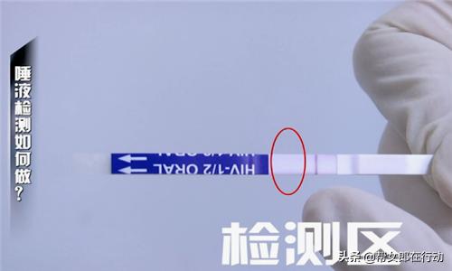 怀疑自己感染艾滋了怎么办,怀疑感染了艾滋病去哪里检测