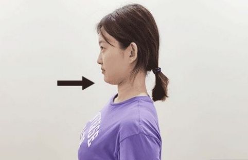 靠墙站真能治驼背？大家都被骗了很多年！