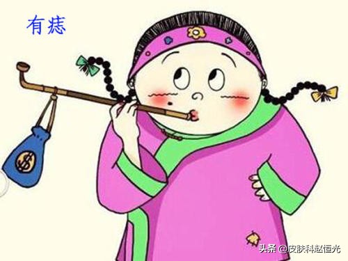 皮肤科祛痣激光治疗需要打麻药吗,皮肤科祛痣激光不用消毒吗