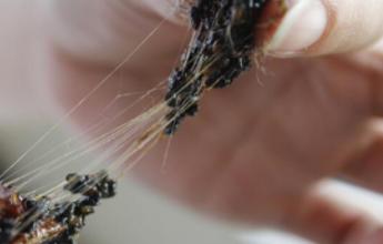 阿胶最有营养的吃法,男性食用阿胶的好处与禁忌