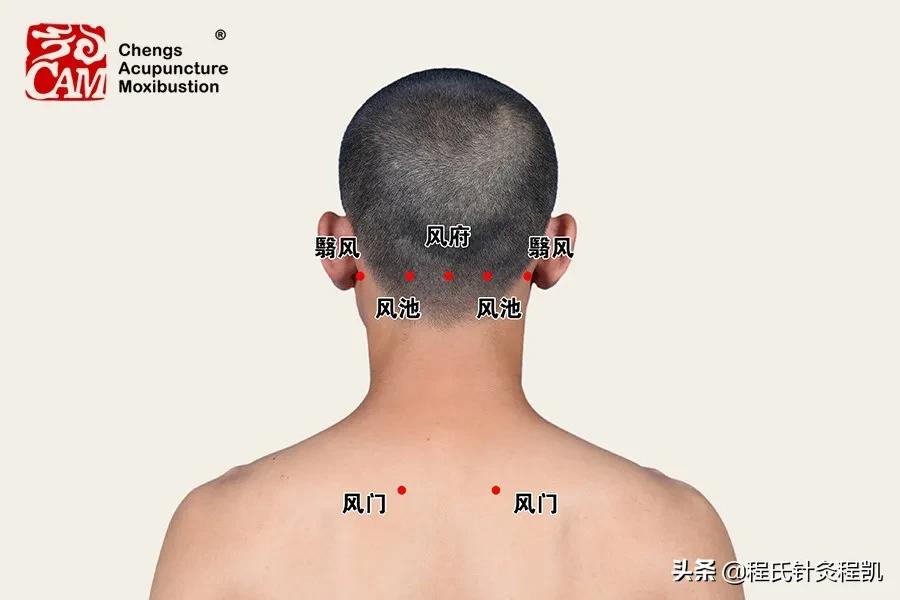 程凯养生说耳鸣视频,程凯养生说耳鸣全部视频