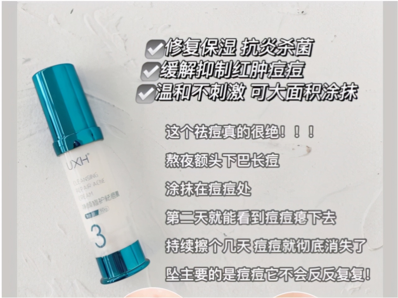 脸上有斑皮肤好过敏怎么办,脸上有红痘过敏怎么回事