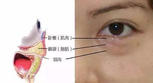 滤镜还是拯救不了眼袋,适合有眼袋的滤镜