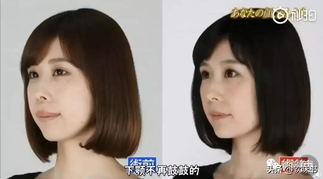 整容脸vs自然脸同龄女星对比,明明是整容脸却没被吐槽过