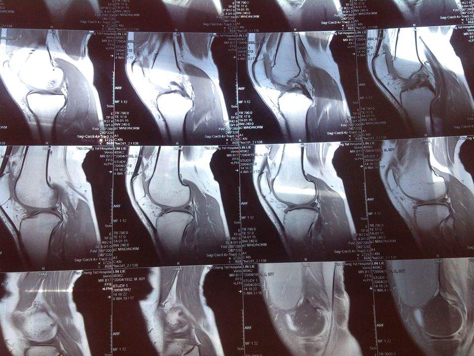 量子力学和相对论的百年矛盾,量子力学与广义相对论哪个更好