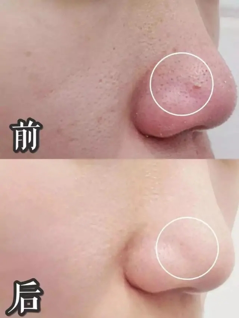 兰蔻阿玛尼洗面奶哪个好,阿玛尼洁面