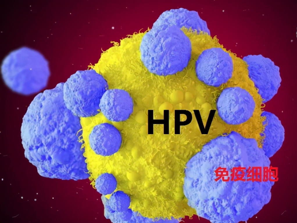 免疫细胞回输治疗宫颈癌,免疫细胞疗法可以有效预防癌症