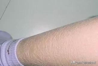 拯救干皮和鸡皮的身体乳,拯救干皮的身体乳