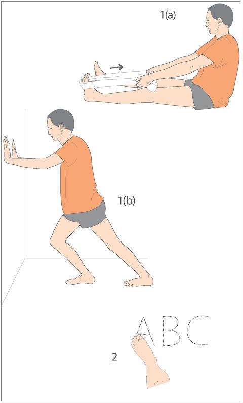 治疗扁平足,聊聊足弓塌陷