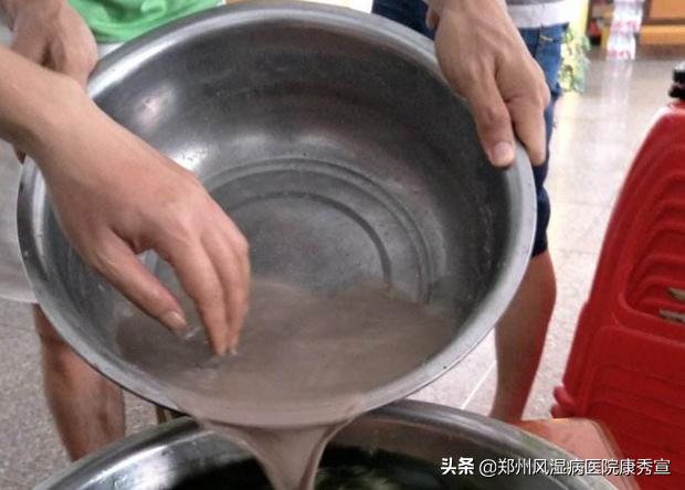 20岁得了类风湿还能活多久,20岁怎么会有类风湿