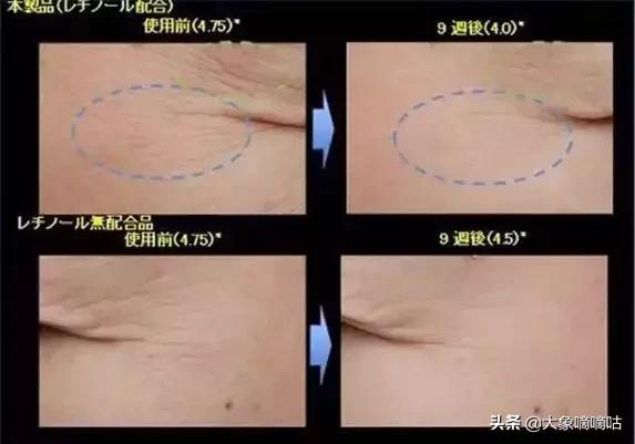 哪一款眼霜适合去皱紧致,能真正有效去皱的眼霜