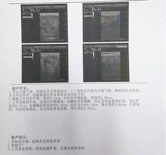 猫咪肾衰竭4级救活的概率大么,猫咪肾衰竭治愈率