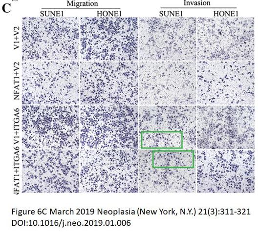 中山大学肿瘤防治中心，广州医科大学附属肿瘤医院发表论文遭质疑