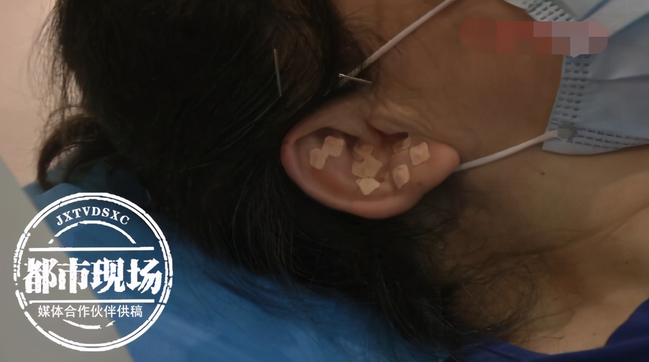 高温会导致突聋吗,气温下降谨防突发性耳聋