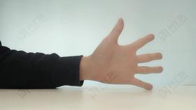 用手机大拇指腱鞘炎能自愈吗,长时间玩手机手腕腱鞘炎的案例