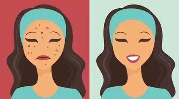 妆后起皮卡粉怎么办,化完妆太卡粉怎么补救