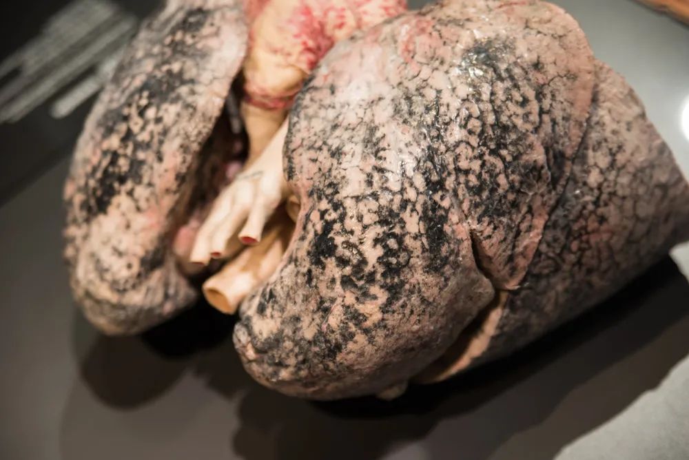 戒烟后变黑的肺能恢复吗,戒烟之后变黑的肺还能白回来吗