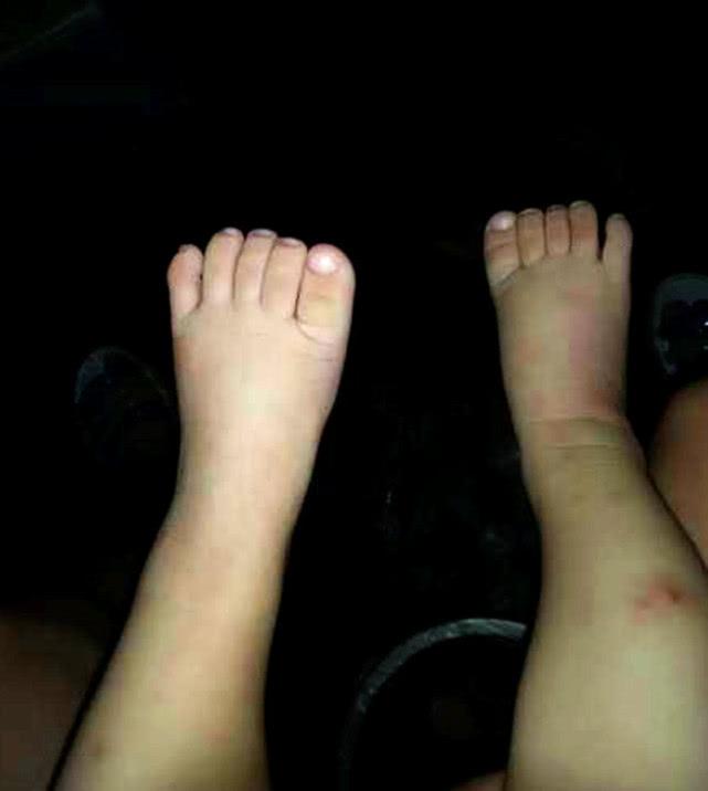 大拇脚趾长俗语怎么说,二脚趾比大脚趾长代表不孝顺吗