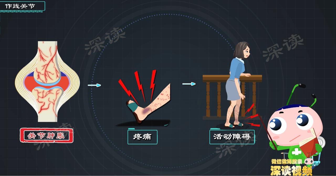 肾性过敏性紫癜多久出现血尿,肾型过敏性紫癜出现血尿时间