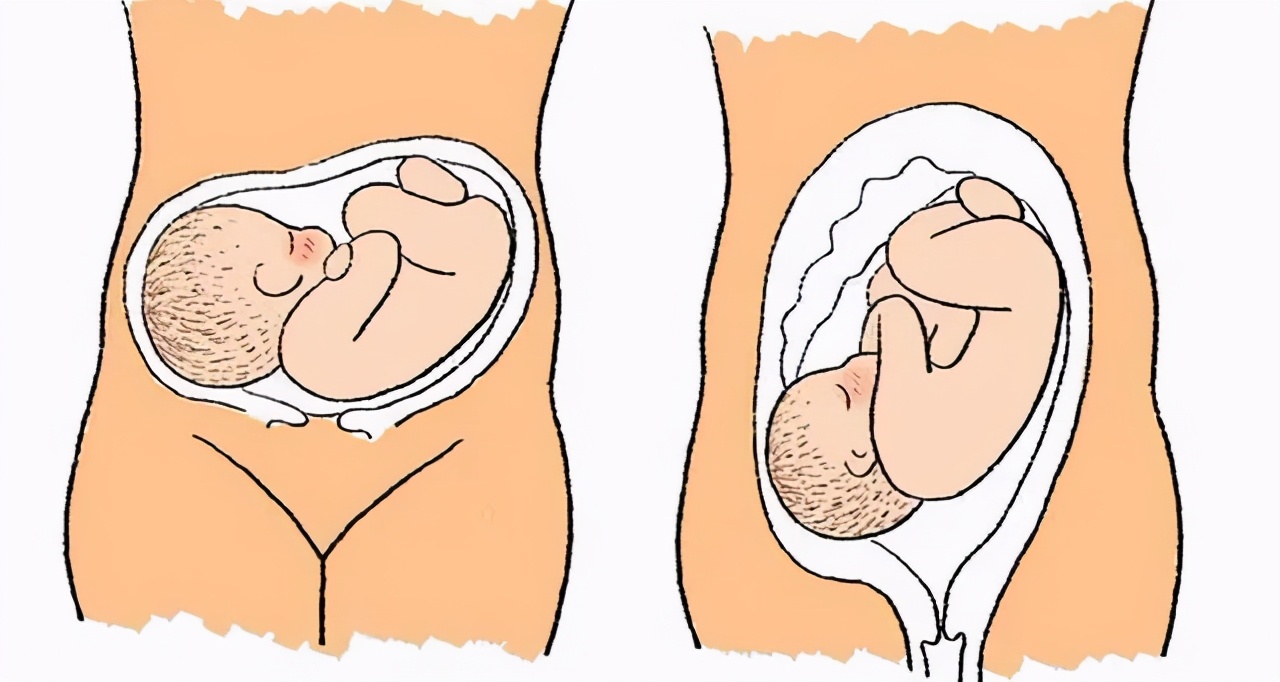 多少周剖腹产算足月,多少周剖腹产好呢