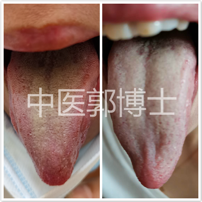 黄带多用什么药能治,黄带多中医怎么治疗