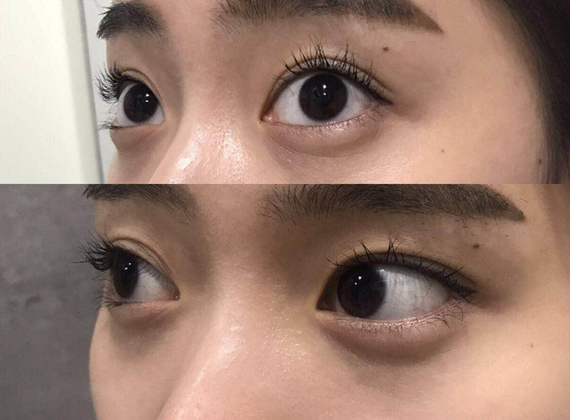 眼部持续温热有好处吗,眼部如何保持清澈