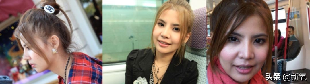 18岁土肥圆豪掷800万全身整形，鼻子6次大整假体穿出，效果却超美