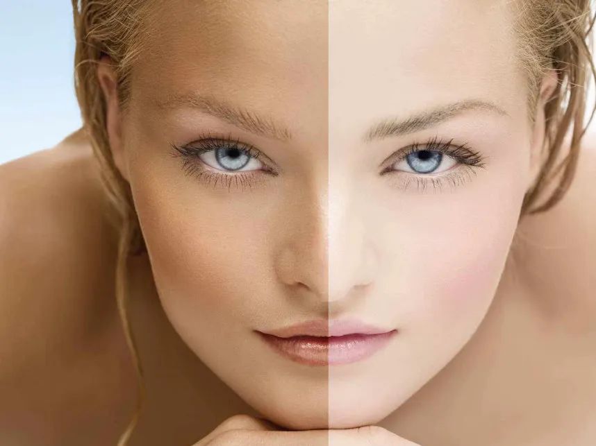 黄黑皮怎么变白高级感,黄黑皮如何养成干净皮肤