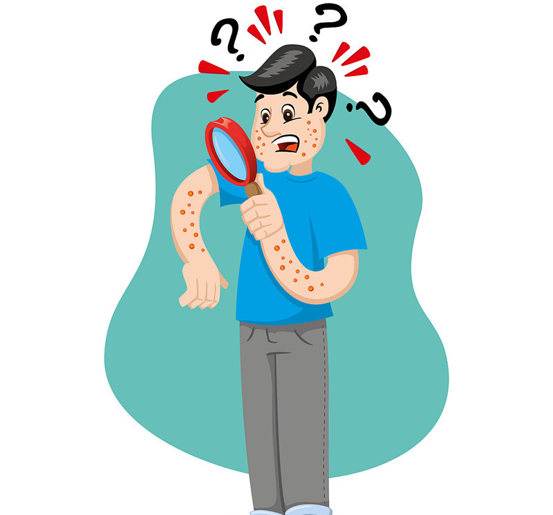 异位性皮肤炎的美丽与哀愁