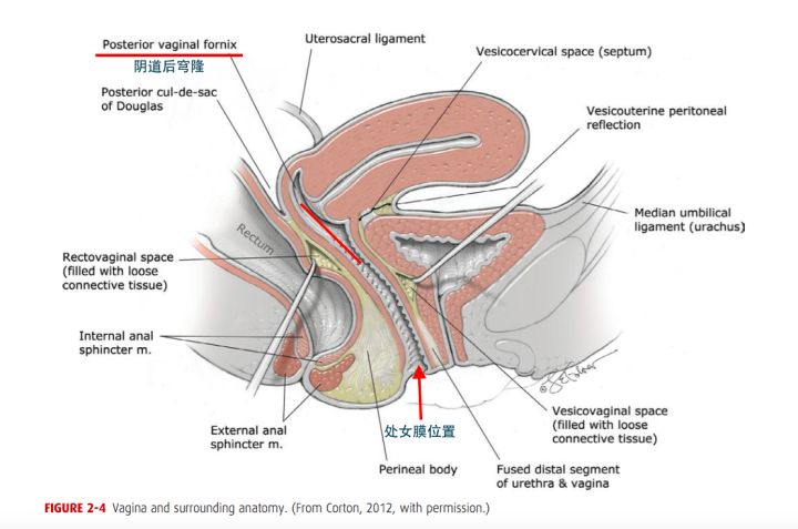 女性阴道出血常见症状,妇女阴道出血有哪些症状
